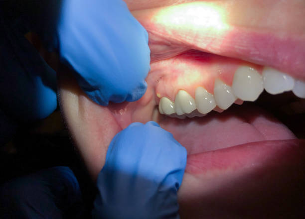 Best Knocked-Out Tooth Emergency  in Jonesville, VA
