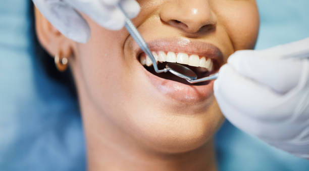 Emergency Dental Filling Replacement in VA