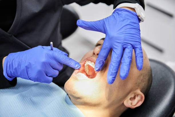 Best Teeth Whitening  in Jonesville, VA